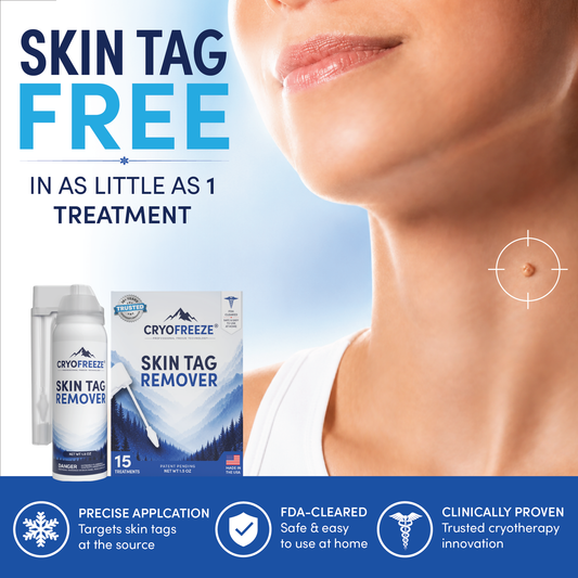 CryoFreeze® Skin Tag Remover