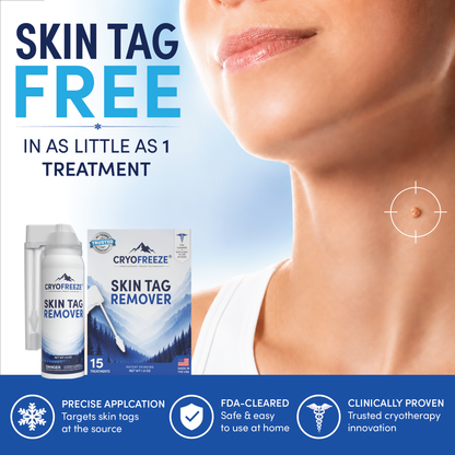 CryoFreeze® Skin Tag Remover